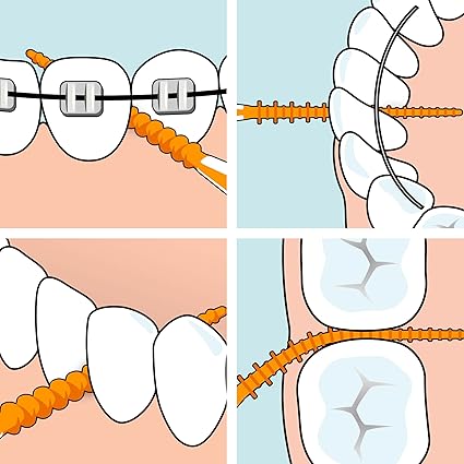 TePe EasyPick Toothpicks, Orange, ISO XS-S, 60pcs, Dental Plaque Removal Tool, efficient and Easy Cleaning Between The Teeth, toothpicks for Narrow Gaps